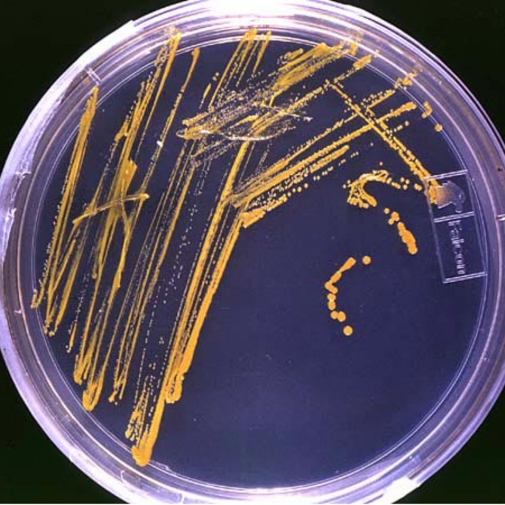 microbiotica intestinal
